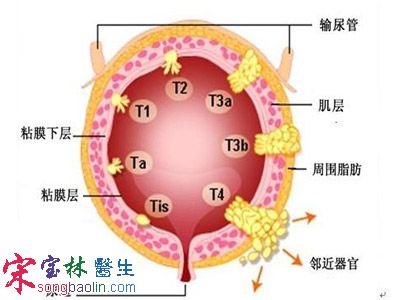 Ǽ<a href=http://www.songbaolin.cn/zhongliu/pangguang/ target=_blank class=infotextkey>װ</a>ҩȾȻ˻Ч